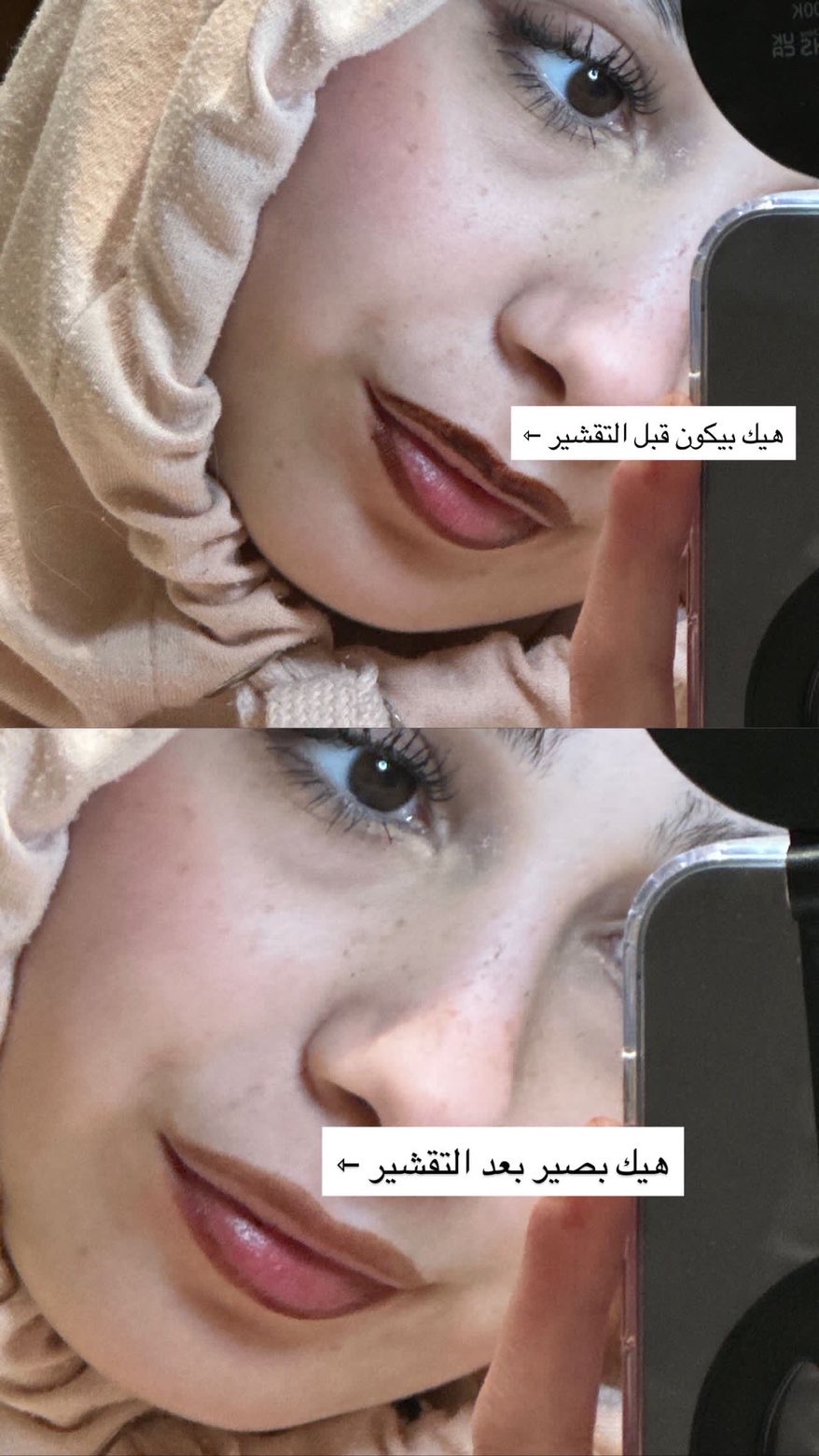 Lip stain before and after peeling method